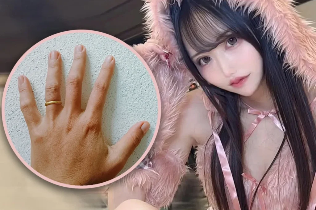 😱Kekasih Yandere di Dunia Nyata? Wanita Jepang Potong Jari Pasangannya karena Tak Mau Dia Menikah dengan Orang Lain