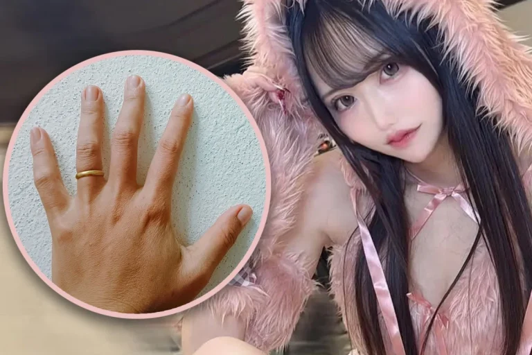 😱Kekasih Yandere di Dunia Nyata? Wanita Jepang Potong Jari Pasangannya karena Tak Mau Dia Menikah dengan Orang Lain